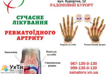 LIKUVANNYA REVMATOYIDNOGO ARTRYTU Дошка оголошень УХТИ