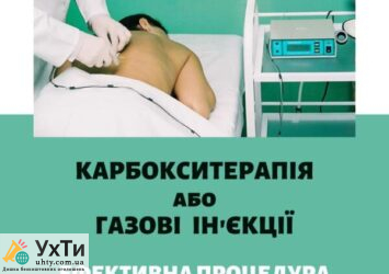 karboksyterapiya Дошка оголошень УХТИ