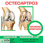 OSTEOARTROZ Дошка оголошень УХТИ