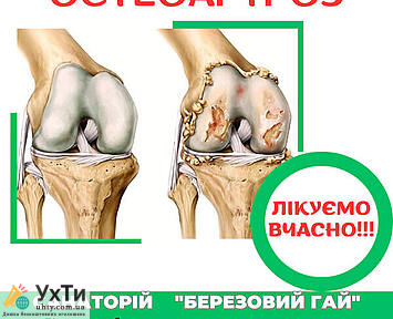 OSTEOARTROZ Дошка оголошень УХТИ