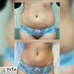 Косметолог-эстет | Объявления УХТЫ Марганец | kalus-21301