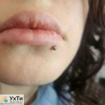 PIERCING: ears, lobes, cartilage | Advertisement EAR PIERCING Novograd-Volynskyi | 10000-31229