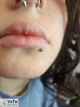 PIERCING: ears, lobes, cartilage | Advertisement EAR PIERCING Novograd-Volynskyi | 10000-31229