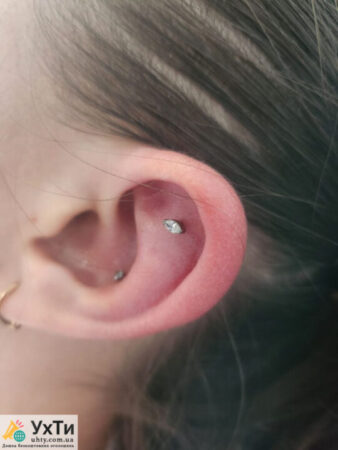 PIERCING: ears, lobes, cartilage | Advertisements EAR PIERCING Novograd-Volynskyi | img_2-31234